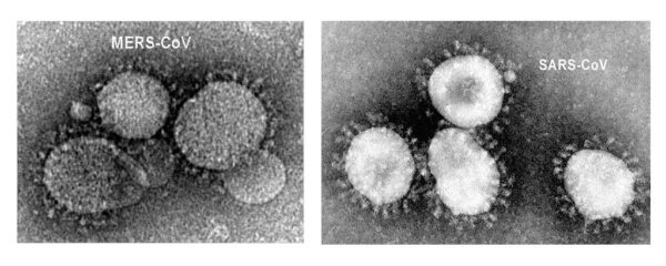 mers-sars.jpg